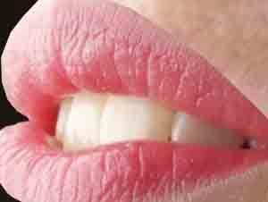 Foto Noticia Herpes labial: prevención y soluciones
